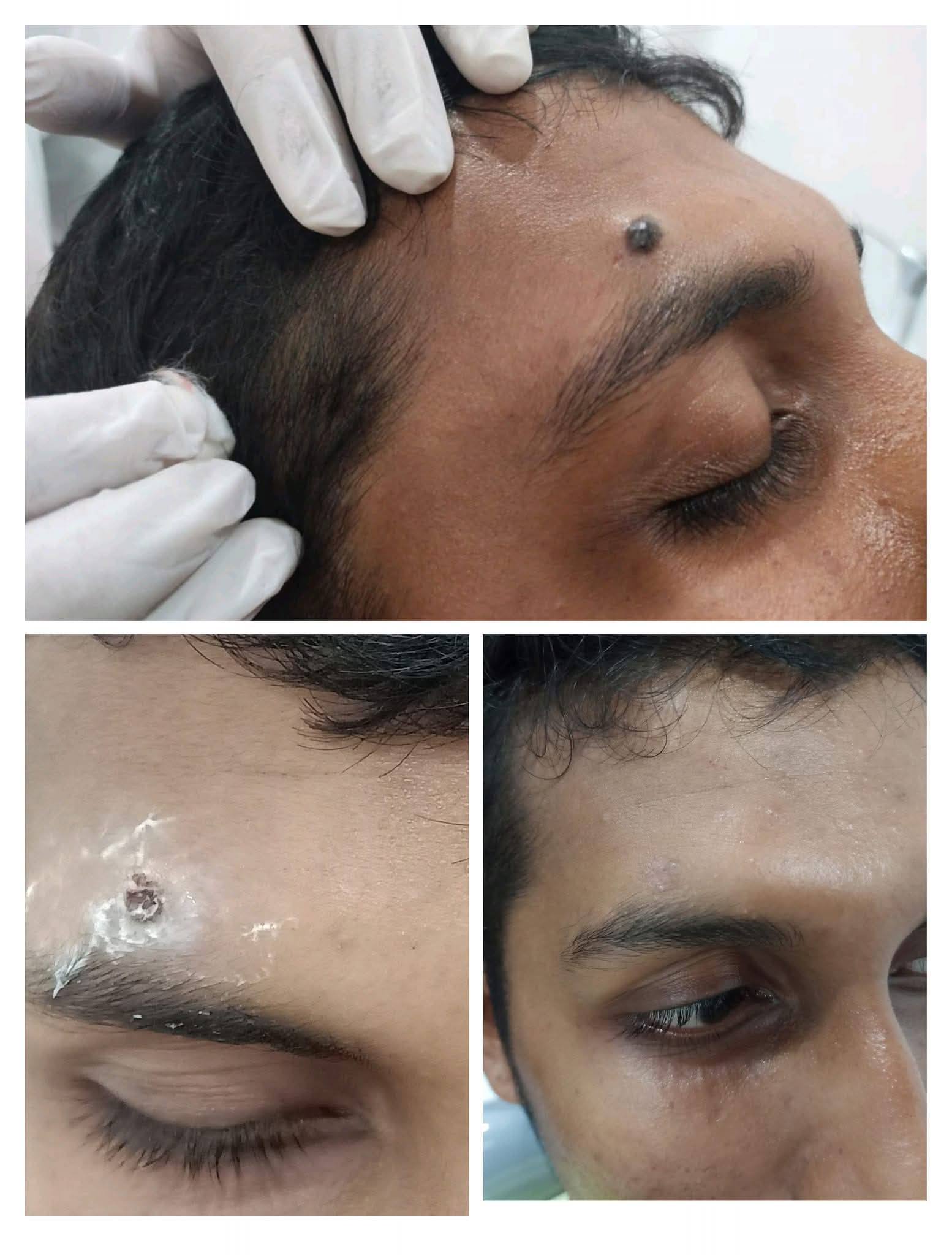 CosmoDent Laser Skin Treatment Suite